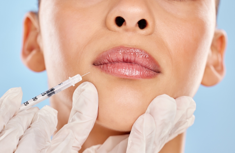 FAQs About Same-Day Lip Filler Treatment in Austin