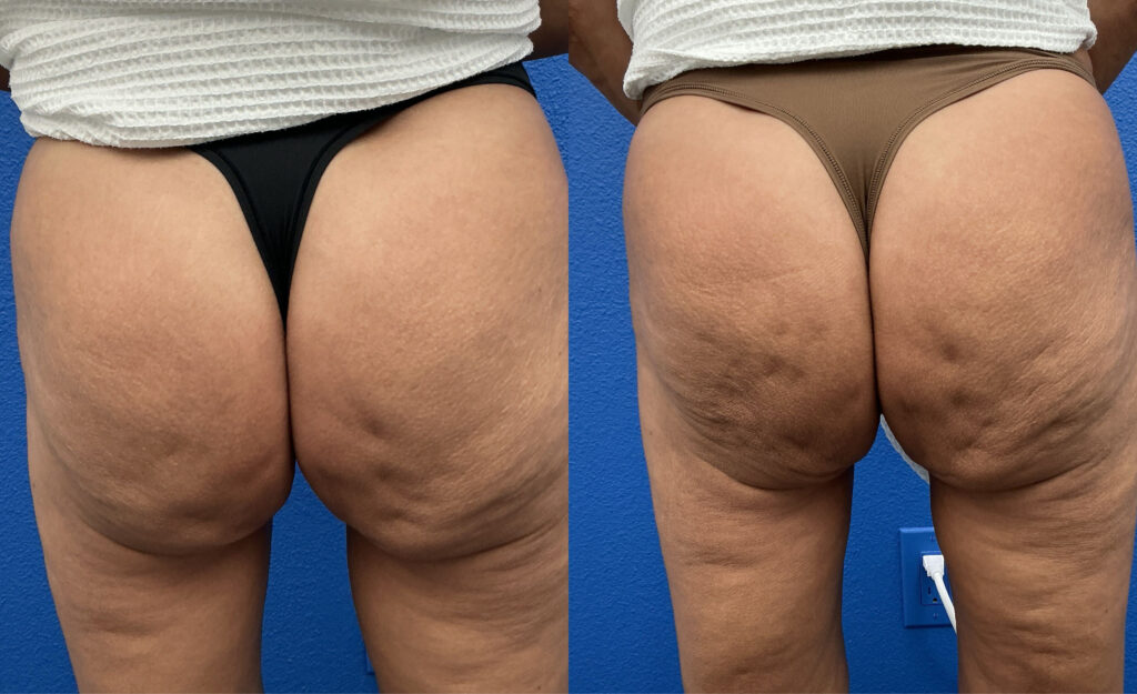 Wondertouch by XOD before (right) and after (left) pictures