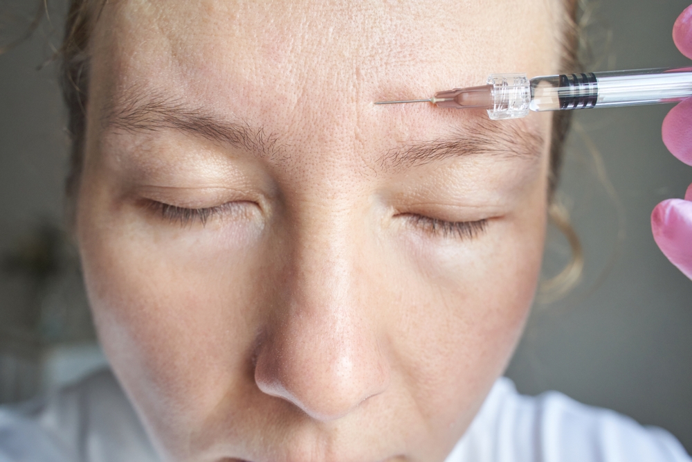 How to Find the Best Botox Provider in Redondo Beach, California for Wrinkle Reduction